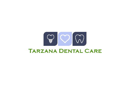 Dental Implants Guide in Tarzana California